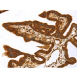 Immunohistochemistry - TP53I11 Antibody from Signalway Antibody (43423) - Antibodies.com