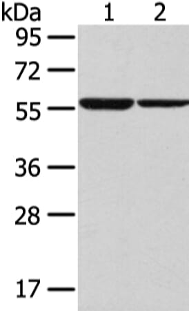Gel: 8% SDS-PAGE Lysate: 40 &#956;g Lane 1-2: K562 and hepg2 cell Primary antibody: 1/300 dilution Secondary antibody: Goat anti rabbit IgG at 1/8000 dilution Exposure time: 30 seconds