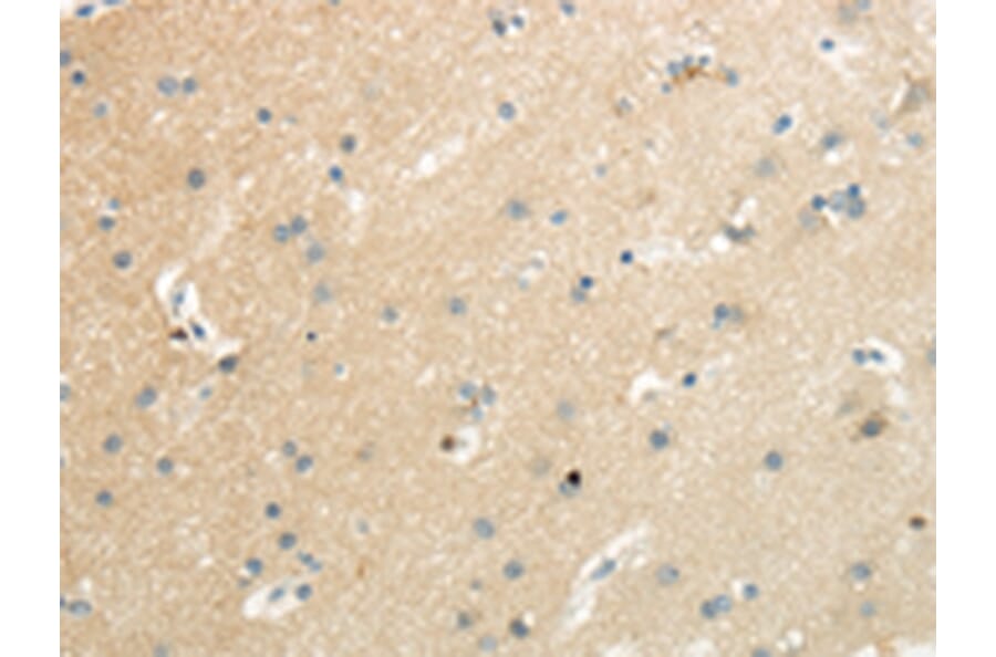 Immunohistochemistry - SLC7A11 Antibody from Signalway Antibody (43437) - Antibodies.com