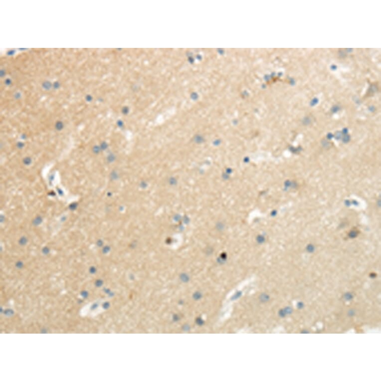 Immunohistochemistry - SLC7A11 Antibody from Signalway Antibody (43437) - Antibodies.com