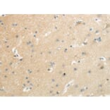 Immunohistochemistry - SLC7A11 Antibody from Signalway Antibody (43437) - Antibodies.com