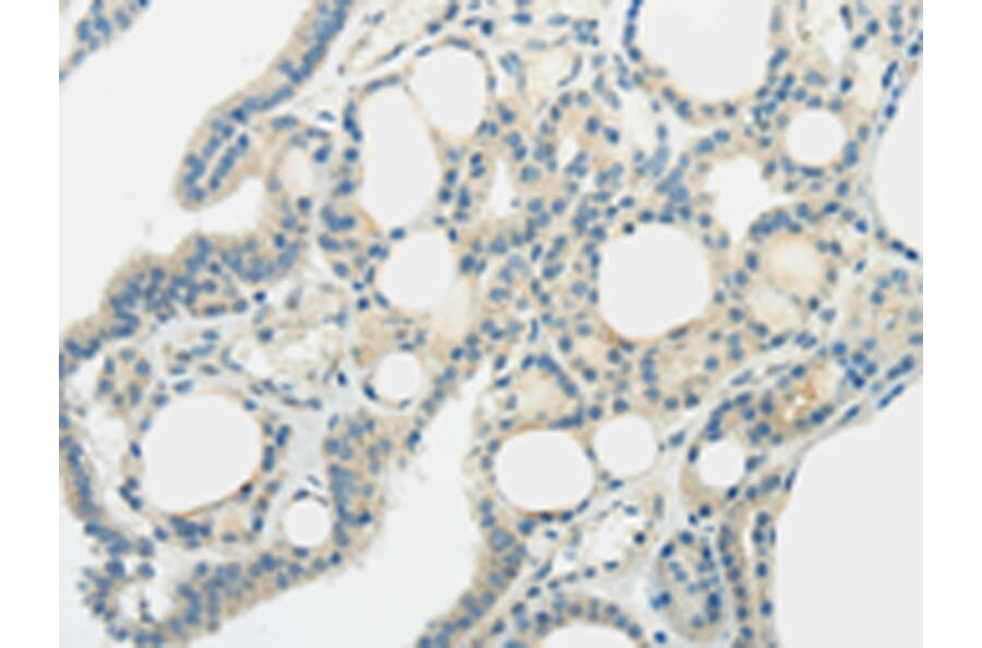 Immunohistochemistry - SLC7A11 Antibody from Signalway Antibody (43437) - Antibodies.com