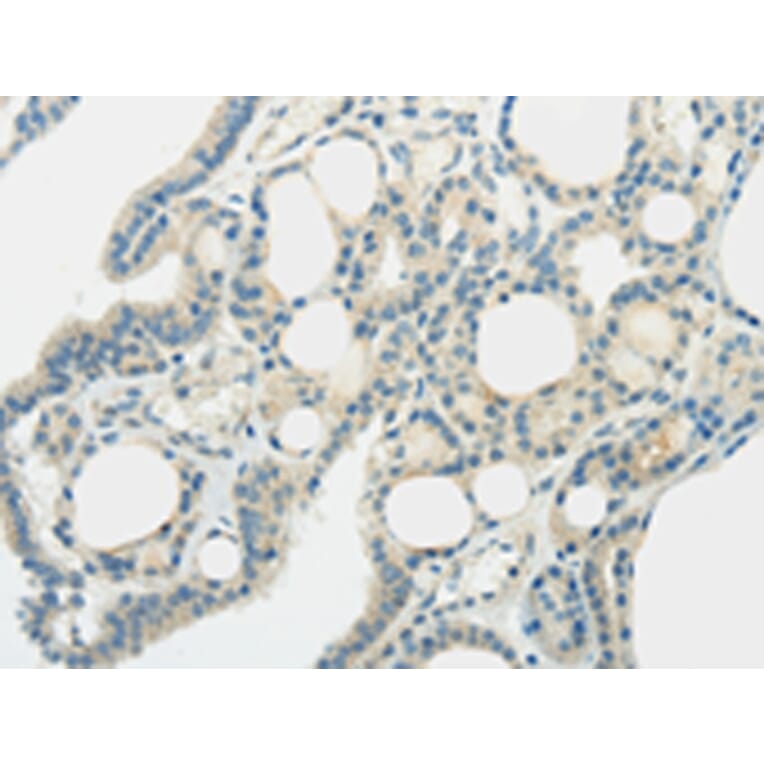 Immunohistochemistry - SLC7A11 Antibody from Signalway Antibody (43437) - Antibodies.com