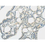 Immunohistochemistry - SLC7A11 Antibody from Signalway Antibody (43437) - Antibodies.com