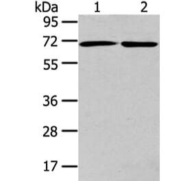 ARFGAP2 Antibody from Signalway Antibody (43440) - Antibodies.com