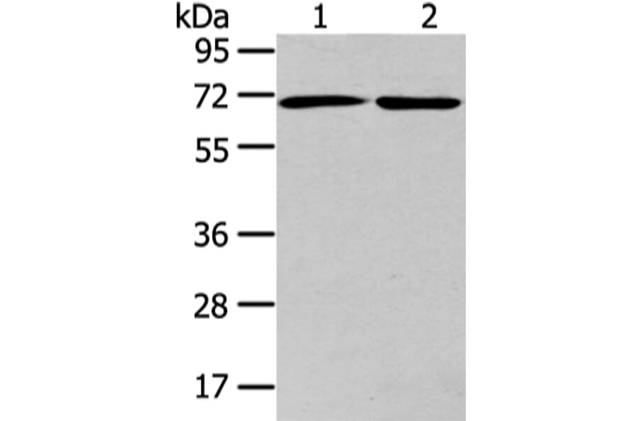 ARFGAP2 Antibody from Signalway Antibody (43440) - Antibodies.com