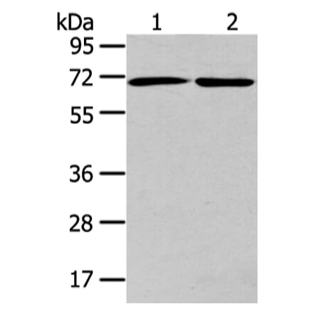 ARFGAP2 Antibody from Signalway Antibody (43440) - Antibodies.com