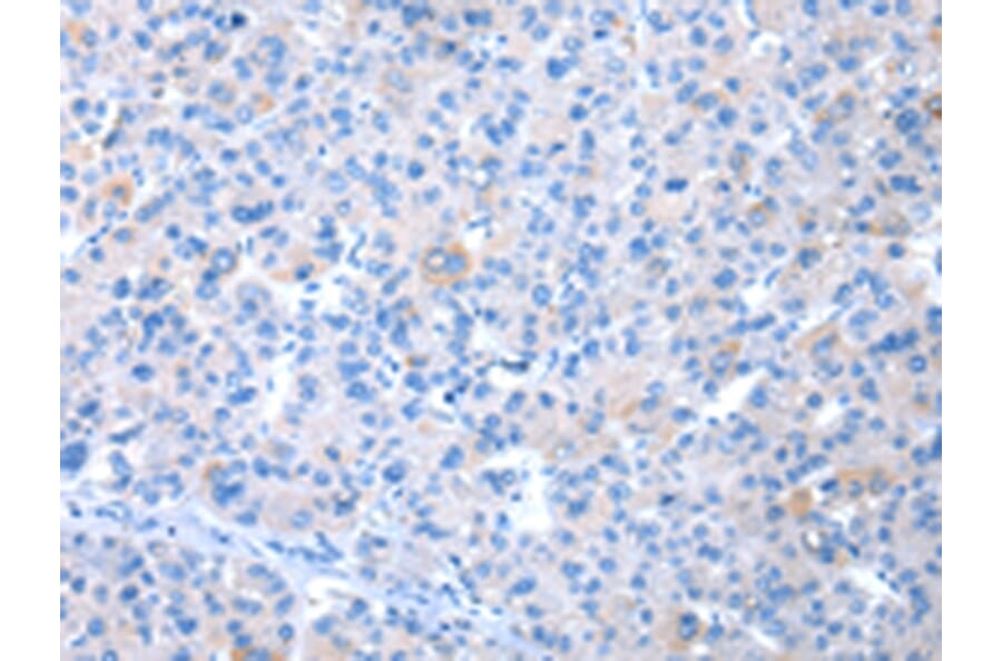 Immunohistochemistry - COLEC12 Antibody from Signalway Antibody (43450) - Antibodies.com