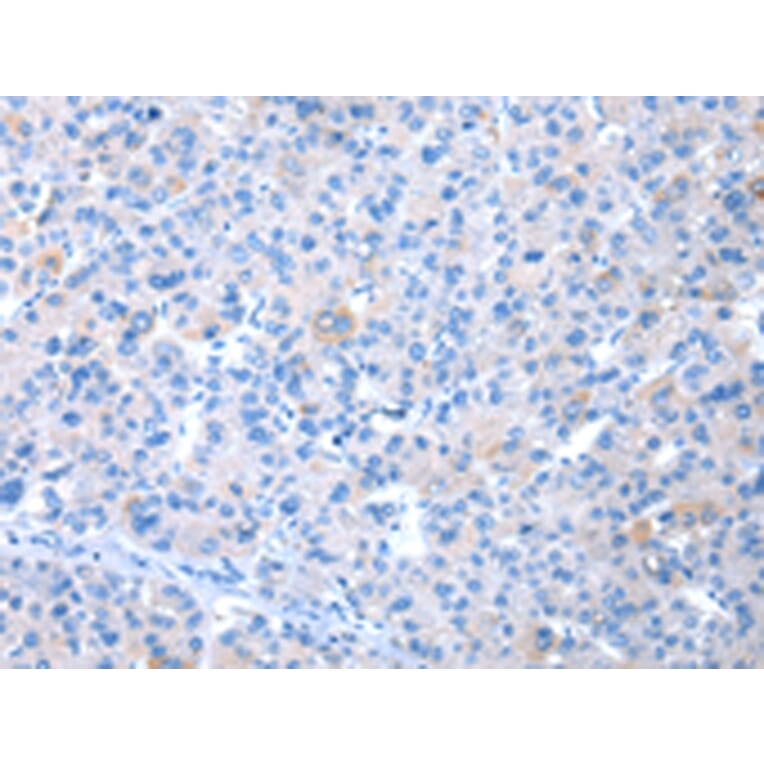 Immunohistochemistry - COLEC12 Antibody from Signalway Antibody (43450) - Antibodies.com