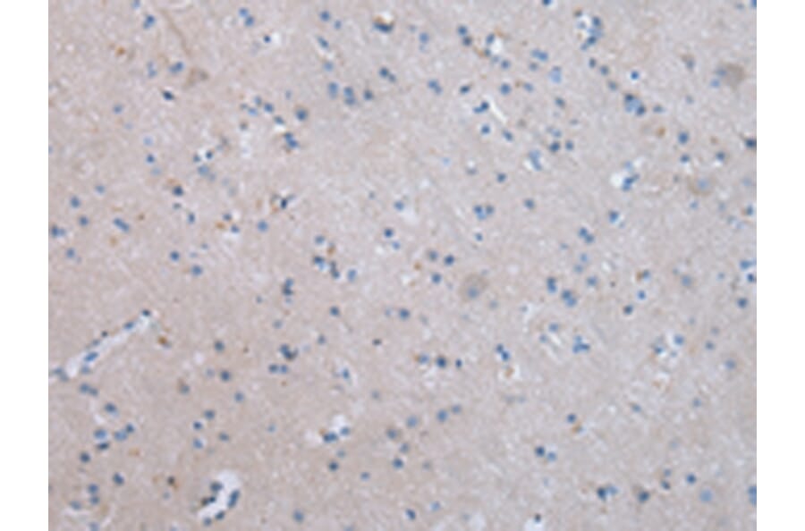 Immunohistochemistry - COLEC12 Antibody from Signalway Antibody (43450) - Antibodies.com