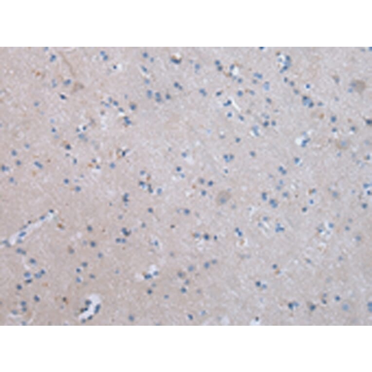 Immunohistochemistry - COLEC12 Antibody from Signalway Antibody (43450) - Antibodies.com