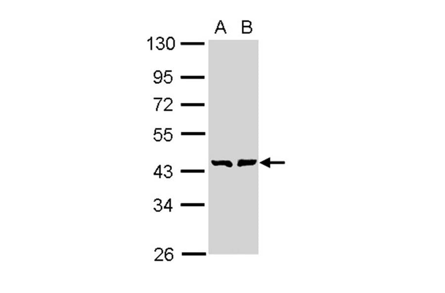 GDP-mannose 4,6-dehydratase antibody from Signalway Antibody (23004) - Antibodies.com