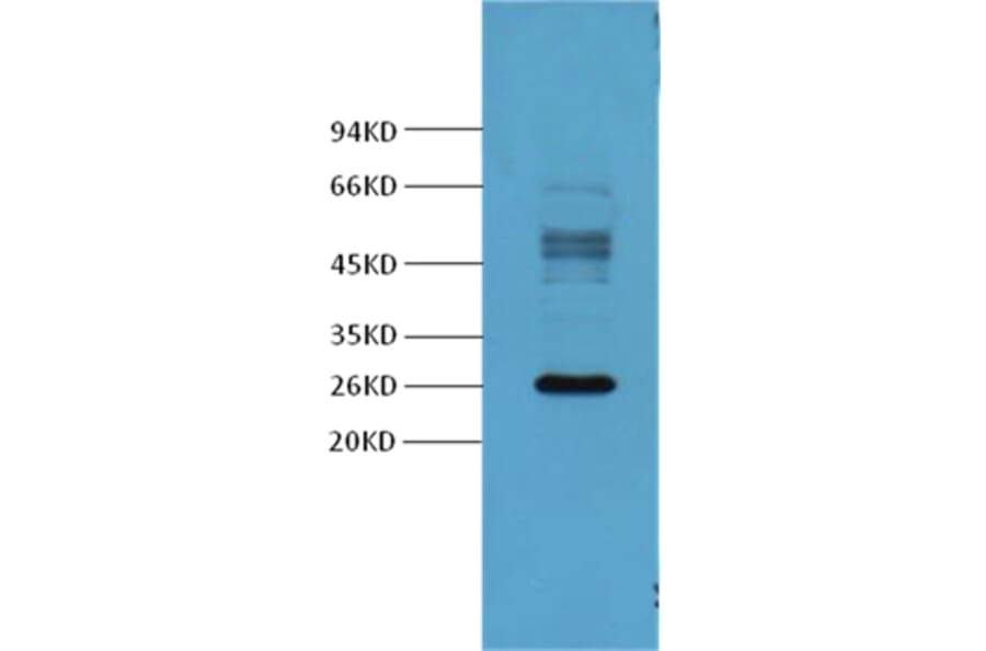 Western blot - Galectin-3 Mouse Monoclonal Antibody from Signalway Antibody (37995) - Antibodies.com