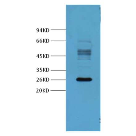 Western blot - Galectin-3 Mouse Monoclonal Antibody from Signalway Antibody (37995) - Antibodies.com