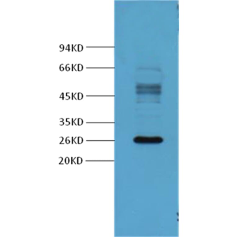 Western blot - Galectin-3 Mouse Monoclonal Antibody from Signalway Antibody (37995) - Antibodies.com