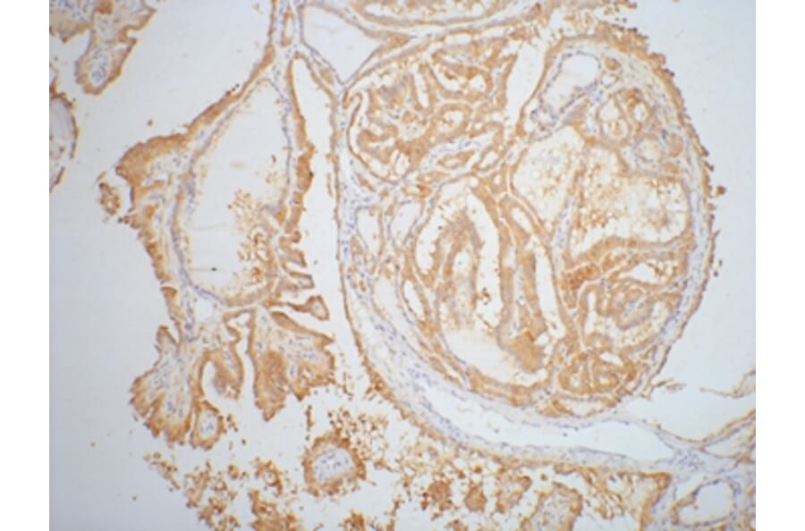 Galectin-3 Mouse Monoclonal Antibody from Signalway Antibody (37995) - Antibodies.com