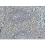 Immunohistochemistry - Active Caspase-3 Monoclonal Antibody from Signalway Antibody (40491) - Antibodies.com