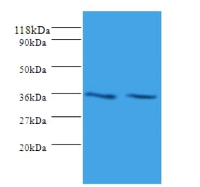 Sorting nexin-20 Polyclonal Antibody from Signalway Antibody (42329) - Antibodies.com