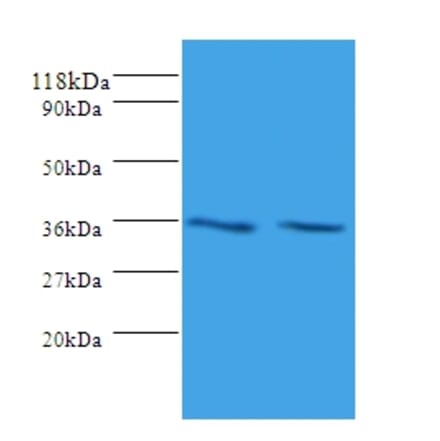 Sorting nexin-20 Polyclonal Antibody from Signalway Antibody (42329) - Antibodies.com