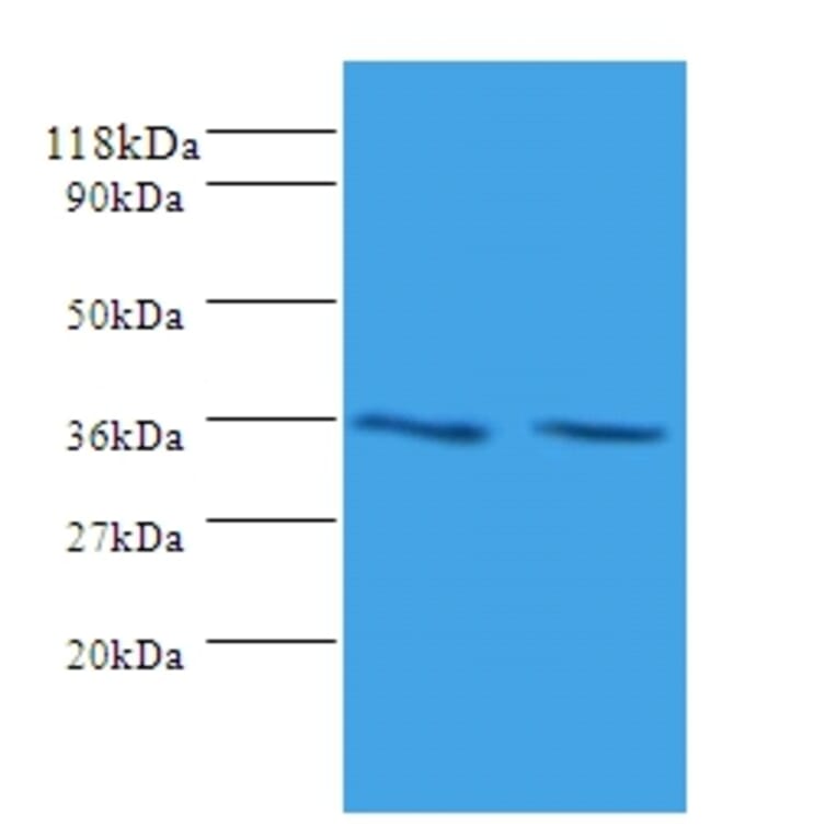 Sorting nexin-20 Polyclonal Antibody from Signalway Antibody (42329) - Antibodies.com