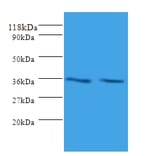 Sorting nexin-20 Polyclonal Antibody from Signalway Antibody (42329) - Antibodies.com