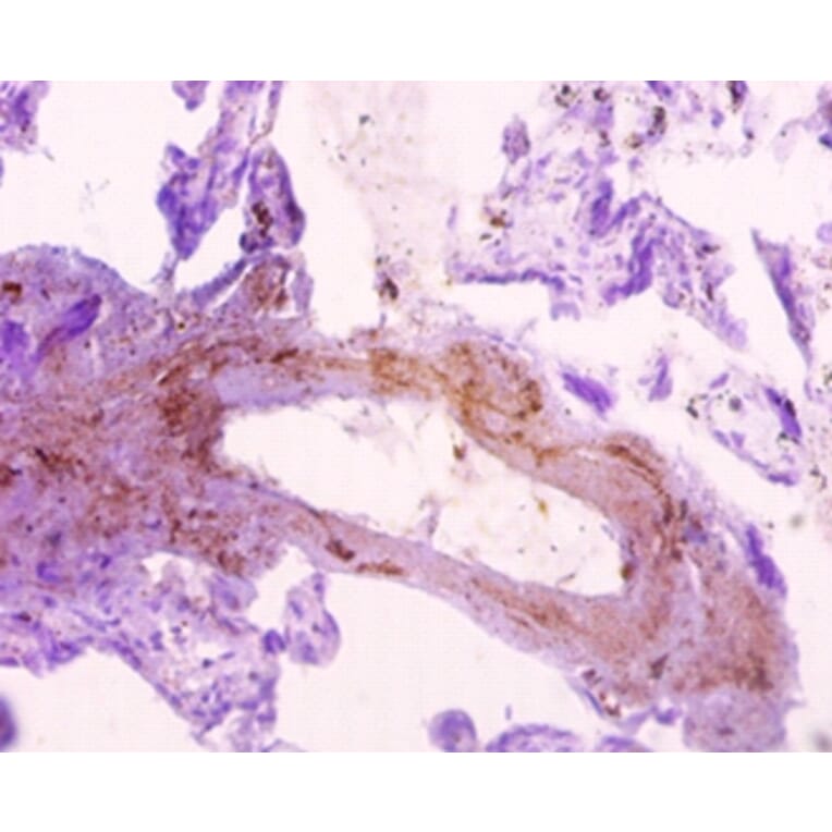 Immunohistochemistry - Sorting nexin-20 Polyclonal Antibody from Signalway Antibody (42329) - Antibodies.com