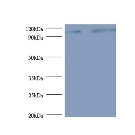 Exostosin-like 3 Polyclonal Antibody from Signalway Antibody (42385) - Antibodies.com