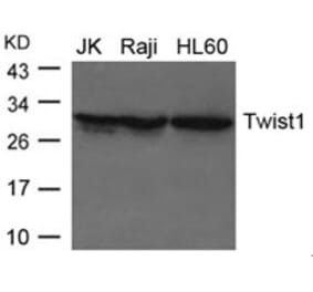 Western blot - Twist1 Antibody from Signalway Antibody (21642) - Antibodies.com