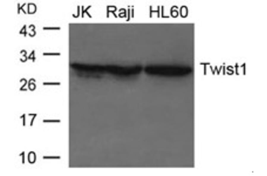 Western blot - Twist1 Antibody from Signalway Antibody (21642) - Antibodies.com