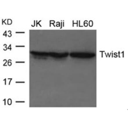 Western blot - Twist1 Antibody from Signalway Antibody (21642) - Antibodies.com