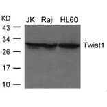 Western blot - Twist1 Antibody from Signalway Antibody (21642) - Antibodies.com