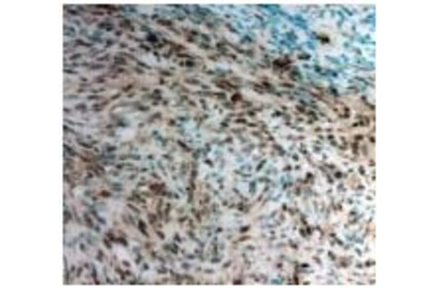 Twist1 Antibody from Signalway Antibody (21642) - Antibodies.com