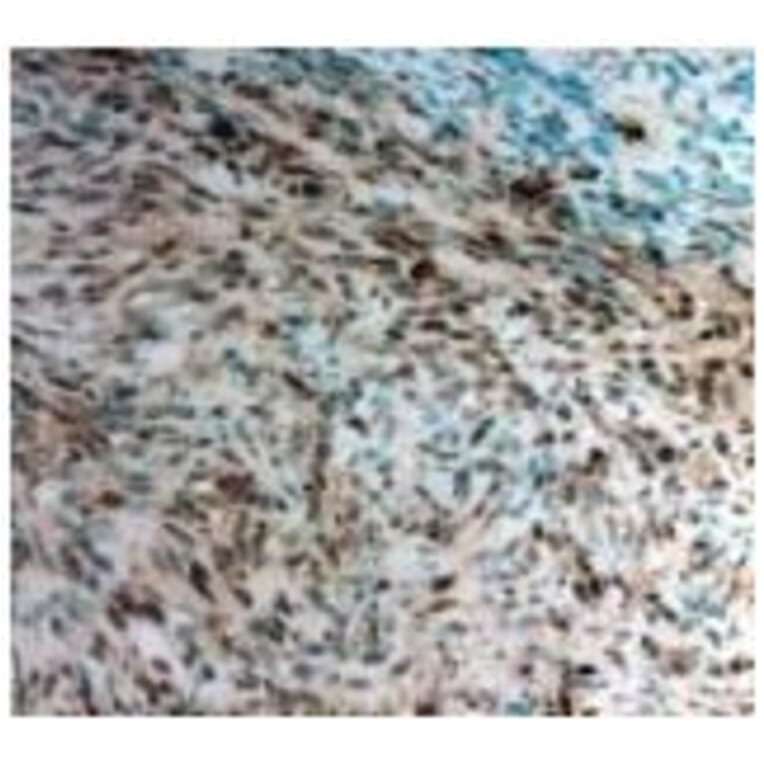 Twist1 Antibody from Signalway Antibody (21642) - Antibodies.com