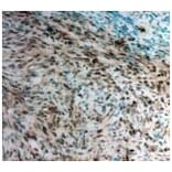 Twist1 Antibody from Signalway Antibody (21642) - Antibodies.com