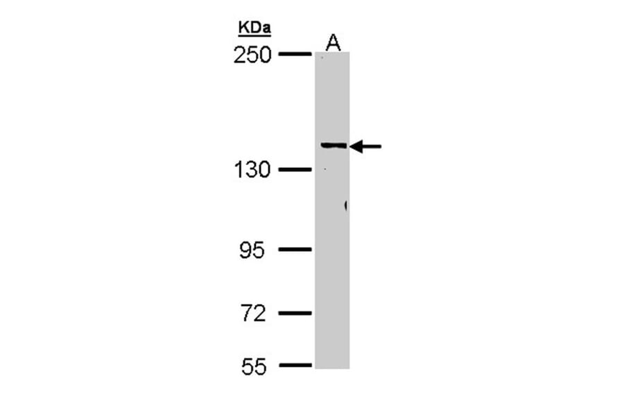 CYFIP2 antibody from Signalway Antibody (22012) - Antibodies.com