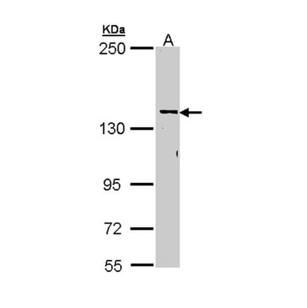 CYFIP2 antibody from Signalway Antibody (22012) - Antibodies.com