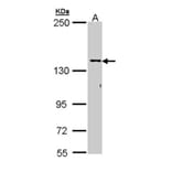 CYFIP2 antibody from Signalway Antibody (22012) - Antibodies.com