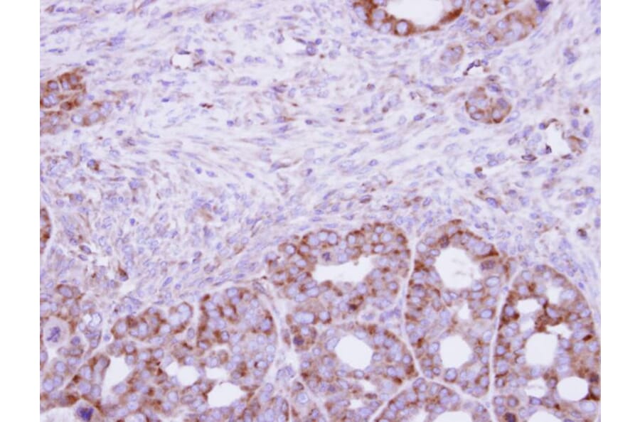 Immunohistochemistry - CYFIP2 antibody from Signalway Antibody (22012) - Antibodies.com