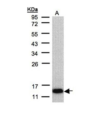 COX6A2 antibody from Signalway Antibody (22072) - Antibodies.com