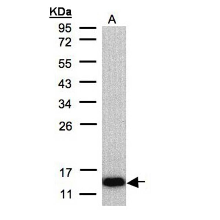 COX6A2 antibody from Signalway Antibody (22072) - Antibodies.com