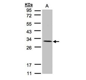 NDUFV2 antibody from Signalway Antibody (22083) - Antibodies.com