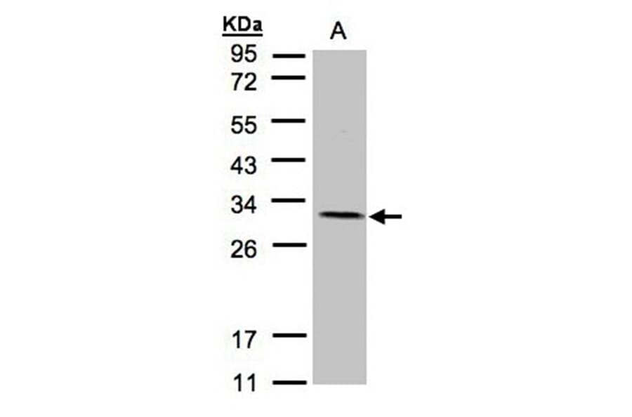 NDUFV2 antibody from Signalway Antibody (22083) - Antibodies.com