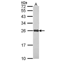 NDUFS8 antibody from Signalway Antibody (22088) - Antibodies.com