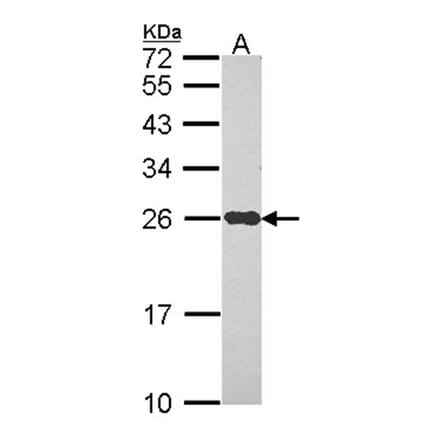 NDUFS8 antibody from Signalway Antibody (22088) - Antibodies.com