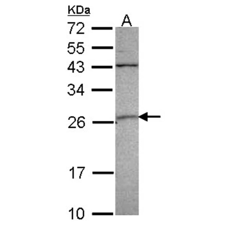 GST A4 antibody from Signalway Antibody (22093) - Antibodies.com