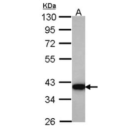 HSD3a antibody from Signalway Antibody (22100) - Antibodies.com