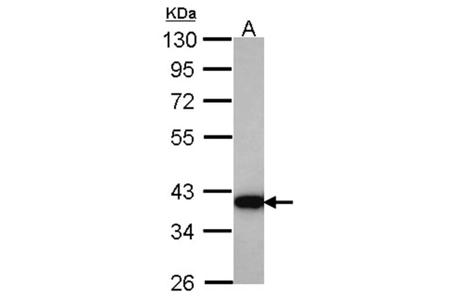 HSD3a antibody from Signalway Antibody (22100) - Antibodies.com