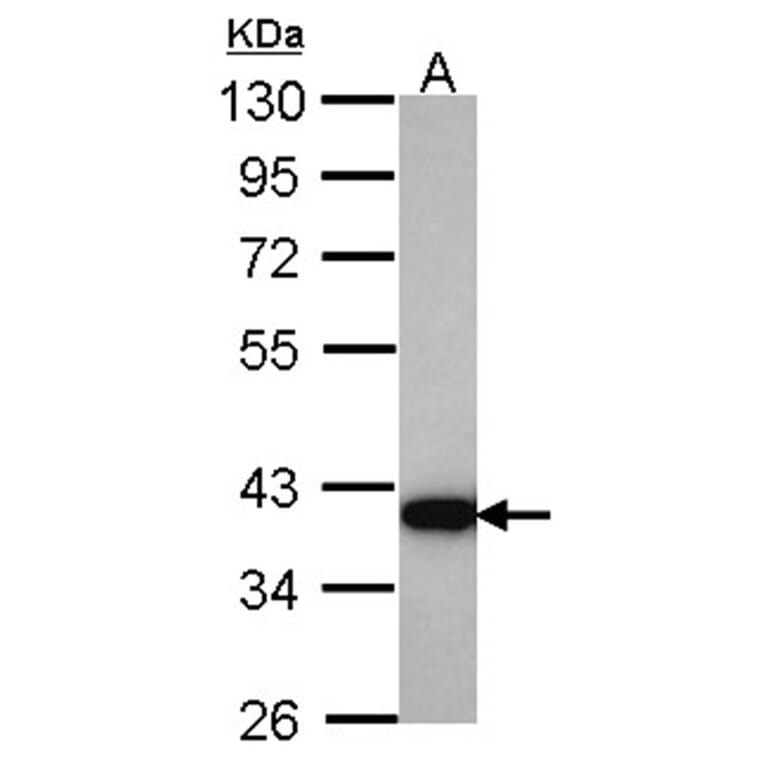HSD3a antibody from Signalway Antibody (22100) - Antibodies.com