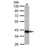 HSD3a antibody from Signalway Antibody (22100) - Antibodies.com