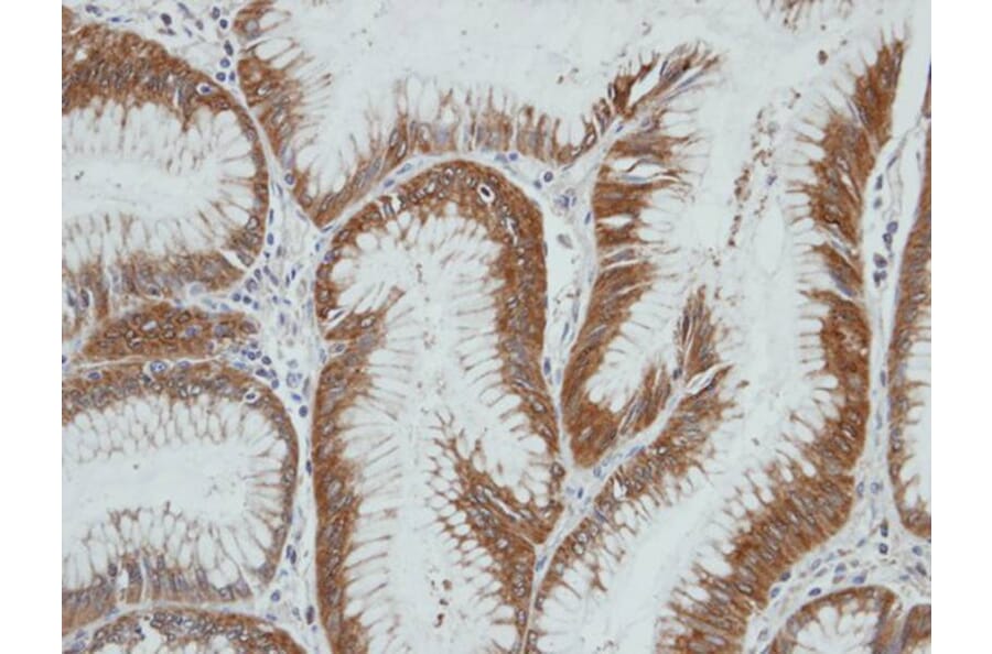 Immunohistochemistry - HSD3a antibody from Signalway Antibody (22100) - Antibodies.com